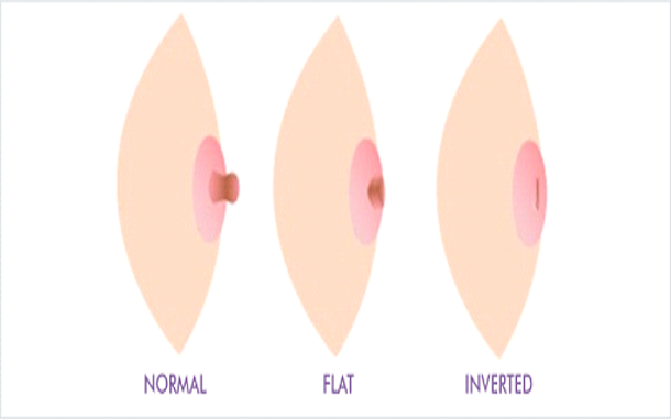 Types Of Female Nipples 2